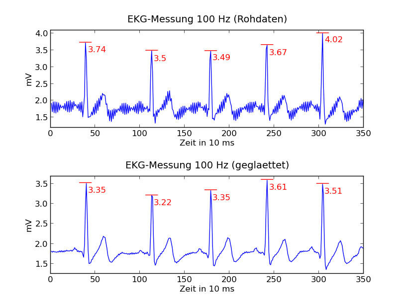 EKG-Messung mit Aufnahmefrequenz von 100 Hz